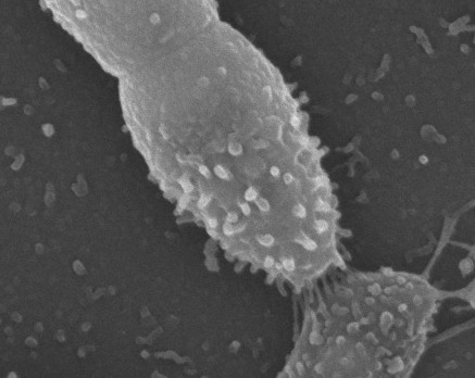 An electron microscope image of a microbe. 