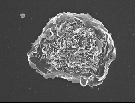 Black and white image of an alveolar macrophage