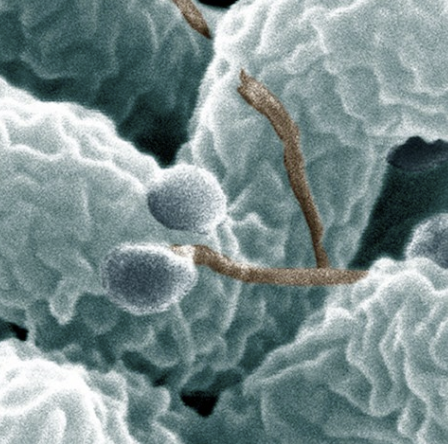 An SEM image of campylobacter jejuni